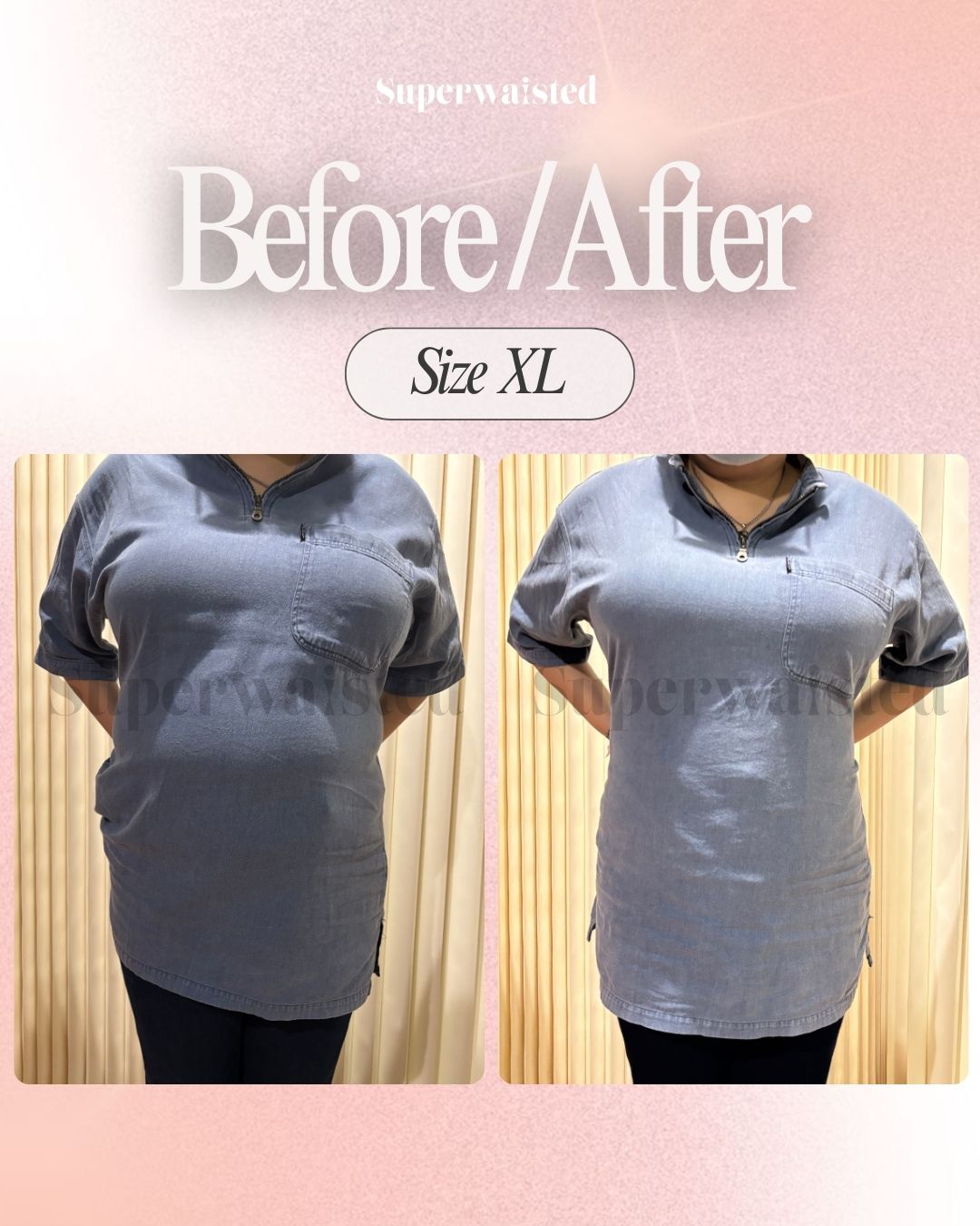 Before and After - Size XL